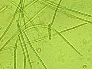 Cyanobactérie Anabaena